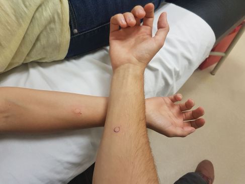 Piqûres à l'hopital de Baños